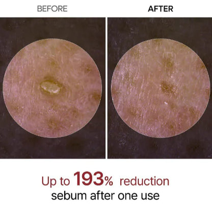 Rice Radiance Exfoliating Serum